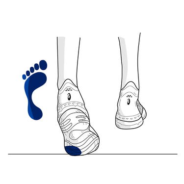 Supination / Under-Pronation